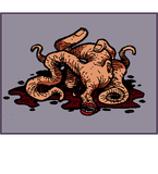 Fleshy Mass