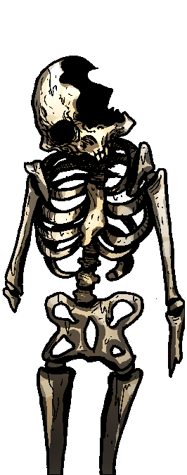 Failed Skeleton